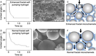 An enhanced fractal self-pumping dressing with continuous drainage for accelerated burn wound healing